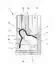 Fig. 01 - Metal part for an electrical connection device, a method of producing same and an electrical terminal equipped therewith