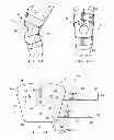 Fig. 02 - UNIVERSAL KNEE ORTHOSIS DEVICE