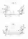Fig. 02 - Jig and saw guides for use in osteotomies
