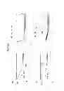 Fig. 16 - Intraocular lens insertion apparatus