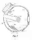 Fig. 04 - Video device to be worn on the head