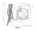 Fig. 07 - Video device to be worn on the head