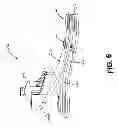 Fig. 07 - Prosthetic foot
