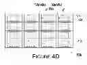 Fig. 11 - Light emitting diode package structure and manufacturing method thereof