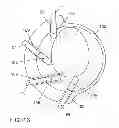 Fig. 10 - Actuator arrangement for a seat and adjusting method