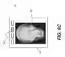 Fig. 09 - ROI SELECTION FOR IMAGING APPARATUS