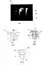 Fig. 02 - Method for forming a joint in a stack of light metal alloy sheets