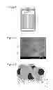 Fig. 02 - Nonaqueous electrolyte secondary battery having a positive electrode including an aluminum foil and a positive electrode active material layer formed thereon
