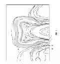 Fig. 02 - Ablation method and device