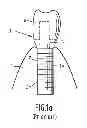 Fig. 02 - Intra-osseous implant