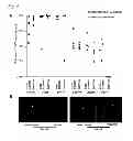 Fig. 06 - DETECTION OF ACUTE MYELOID LEUKAEMIA