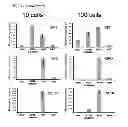 Fig. 33 - DETECTION OF ACUTE MYELOID LEUKAEMIA