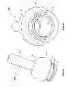 Fig. 08 - Transdermal intraosseous device