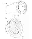 Fig. 09 - Transdermal intraosseous device
