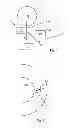 Fig. 03 - Glaucoma drainage devices including vario-stable valves and associated systems and methods