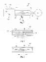 Fig. 05 - Glaucoma drainage devices including vario-stable valves and associated systems and methods