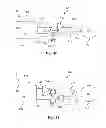 Fig. 06 - Glaucoma drainage devices including vario-stable valves and associated systems and methods