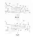 Fig. 09 - Glaucoma drainage devices including vario-stable valves and associated systems and methods