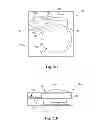 Fig. 11 - Glaucoma drainage devices including vario-stable valves and associated systems and methods