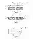 Fig. 13 - Glaucoma drainage devices including vario-stable valves and associated systems and methods