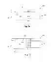 Fig. 14 - Glaucoma drainage devices including vario-stable valves and associated systems and methods