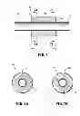 Fig. 08 - Detachable coupling for catheter
