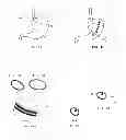 Fig. 02 - Devices for reconfiguring a portion of the gastrointestinal tract