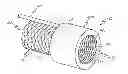 Fig. 01 - TRANSCATHETER AORTIC VALVULOPLASTY DEVICE