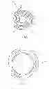 Fig. 04 - TRANSCATHETER AORTIC VALVULOPLASTY DEVICE