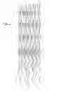 Fig. 05 - Method of treating vascular bifurcations