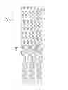 Fig. 07 - Method of treating vascular bifurcations