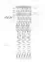 Fig. 13 - Method of treating vascular bifurcations