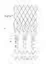 Fig. 17 - Method of treating vascular bifurcations