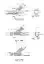 Fig. 28 - Method of treating vascular bifurcations