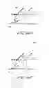 Fig. 32 - Method of treating vascular bifurcations