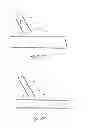 Fig. 35 - Method of treating vascular bifurcations