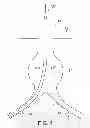 Fig. 02 - Bifurcated endovascular prosthesis having tethered contralateral leg