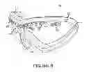Fig. 11 - Protective goggles and lens assemblies with adjustable ventilation having reduced visual obstruction
