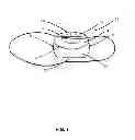 Fig. 02 - FLEXIBLE MIDFOOT ORTHOTIC SHOE INSERT