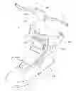 Fig. 01 - Shock-absorbing walk-aiding shoe