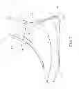 Fig. 06 - Shock-absorbing walk-aiding shoe