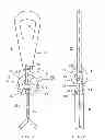 Fig. 02 - Method and apparatus for attaching temporary lifting members to an existing lifting anchor