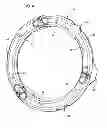 Fig. 05 - Wheel weight assembly