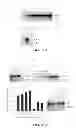 Fig. 05 - Methods of Modifying Insulin Signaling Using Biliverdin Reductase (BVR) and BVR Derived Peptides