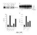 Fig. 07 - Methods of Modifying Insulin Signaling Using Biliverdin Reductase (BVR) and BVR Derived Peptides