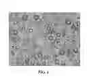 Fig. 02 - HOLLOW MICROSPHERES
