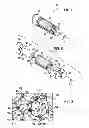 Fig. 02 - Modular implant with secured porous portion