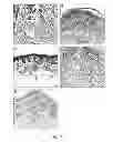 Fig. 23 - MOLECULAR DIAGNOSIS AND CLASSIFICATION OF MALIGNANT MELANOMA