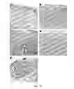 Fig. 24 - MOLECULAR DIAGNOSIS AND CLASSIFICATION OF MALIGNANT MELANOMA