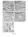 Fig. 26 - MOLECULAR DIAGNOSIS AND CLASSIFICATION OF MALIGNANT MELANOMA